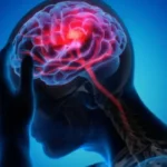 Eat right, stay active, and manage stress to lower risk of strokes: JP Nadda